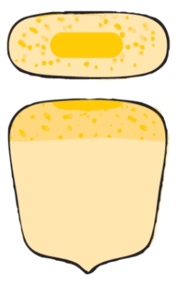 ensilage lentille